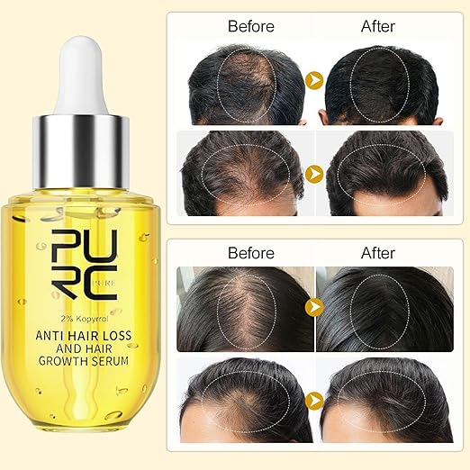 PURC-Sérum anti-chute de cheveux pour hommes et femmes